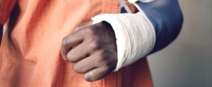 Broken Arm: Signs, Symptoms, & Treatments