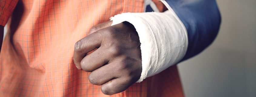 Broken Arm: Signs, Symptoms, & Treatments