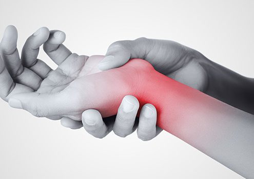 Carpal Tunnel Syndrome