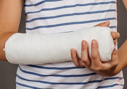 Fractures in Children