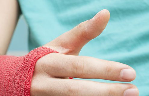 Treating Finger Fractures at Orthopedic Sports Medicine in Downtown Portland Oregon