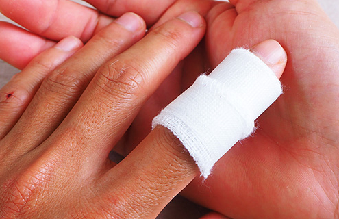 What Is Mallet Finger?