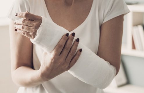 Care of Casts and Splints