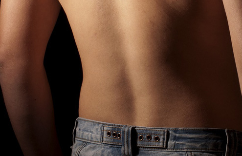 Adult Spondylolisthesis in the Low Back