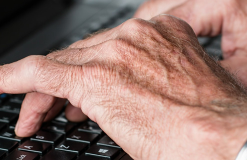 A Patient's Guide to Rheumatoid Arthritis