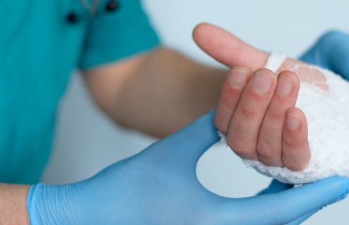 A Surgeons’ Guide to Recovering From Hand Surgery