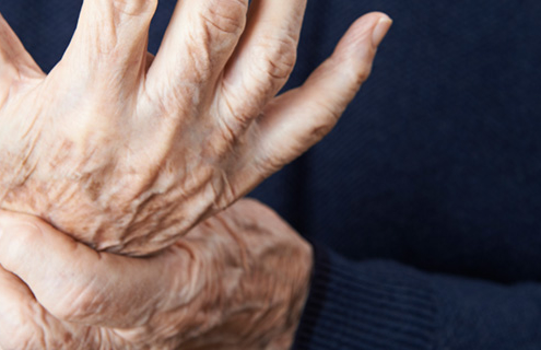 5 Ways to Help Prevent Arthritis