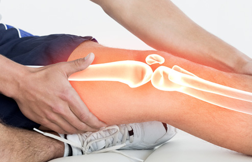 Did I Tear my Meniscus? Symptoms of a Torn Meniscus