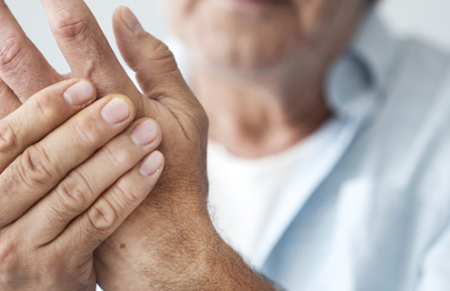 What Is Dupuytren's Disease and How Is It Treated?