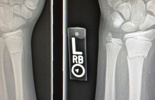 Common Orthopedic Questions Answered: Tests & Treatment