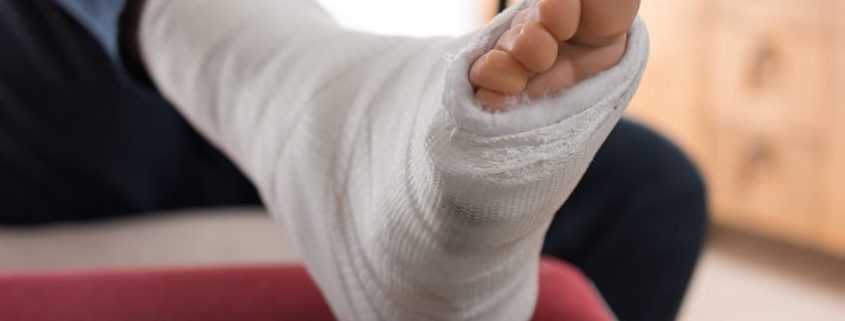 How to Treat Plantar Fasciitis