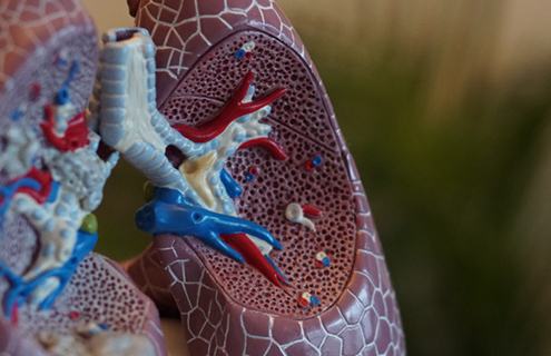 What Does Recovery From COVID-19 Look Like? It Depends. A Pulmonologist Explains.