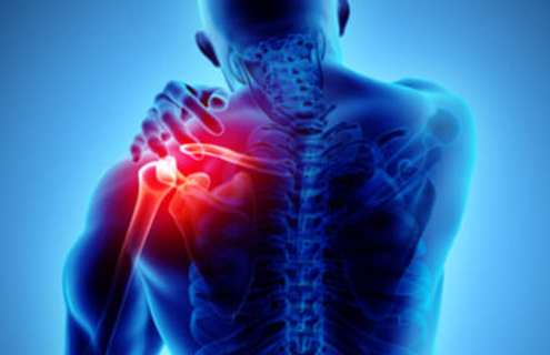 Understanding Compartment Syndrome: What is it and How to Recover