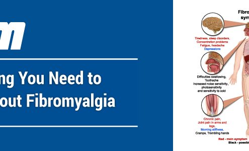 Everything You Need to Know about Fibromyalgia