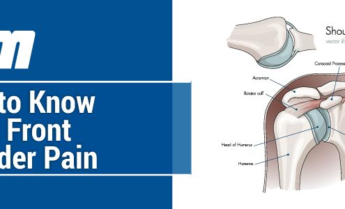 What to Know About Front Shoulder Pain