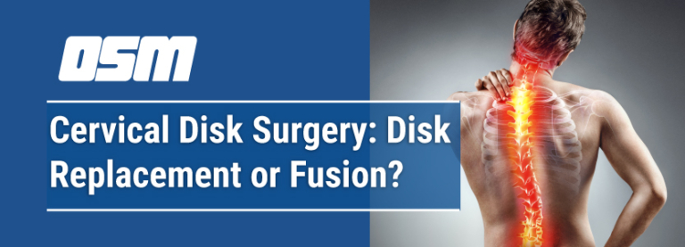 Cervical Disc Surgery Disc Replacement Or Fusion Orthopedic And Sports Medicine