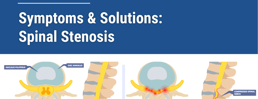 Spinal stenosis