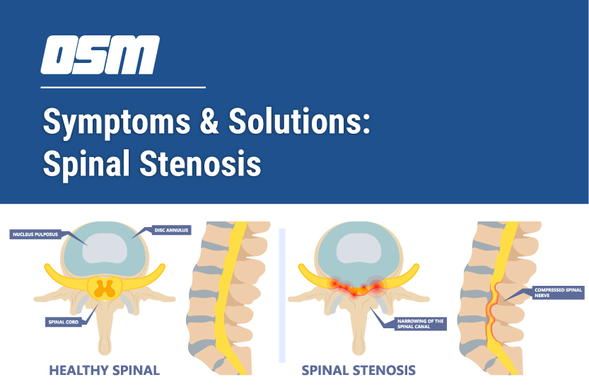 Knowing the Different Types of Spinal Stenosis and overview of Lumbar  stenosis