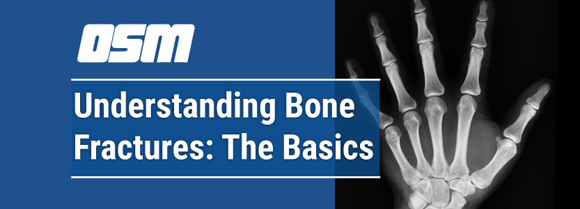 Understanding the Different Types of Bone Fractures - Comprehensive  Orthopaedics