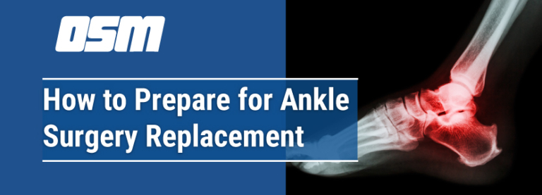 How to Prepare for Ankle Replacement Surgery - Orthopedic & Sports Medicine