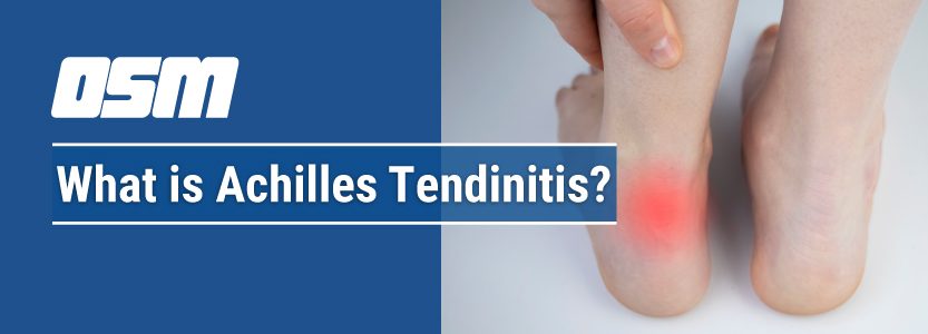 Achilles Tendinosis: Treatment, Symptoms, and More