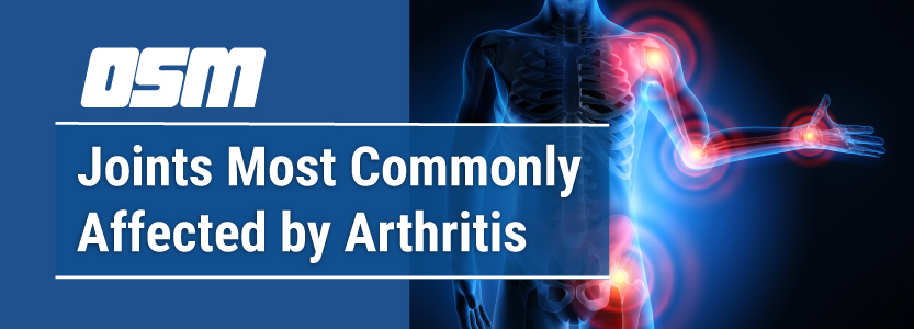 Joints That Are Most Commonly Affected By Arthritis - Orthopedic ...