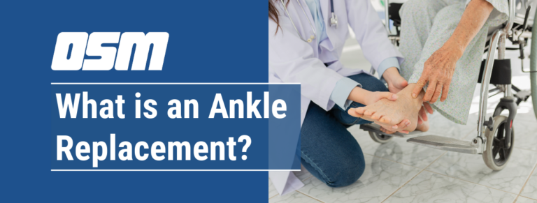 What is an Ankle Replacement? - Orthopedic & Sports Medicine