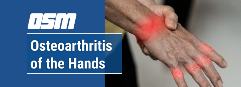 Osteoarthritis of the Hands - Orthopedic & Sports Medicine