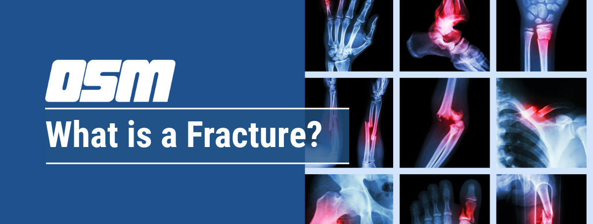 Wht Is A Frac What is a Fracture? - Orthopedic & Sports Medicine